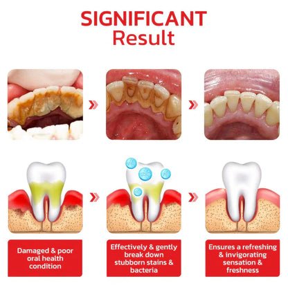 SP4 Ultra+ Whitening Probiotic Toothpaste